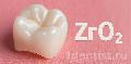 Циркониевая коронка на зуб плюсы и минусы в Волоколамске